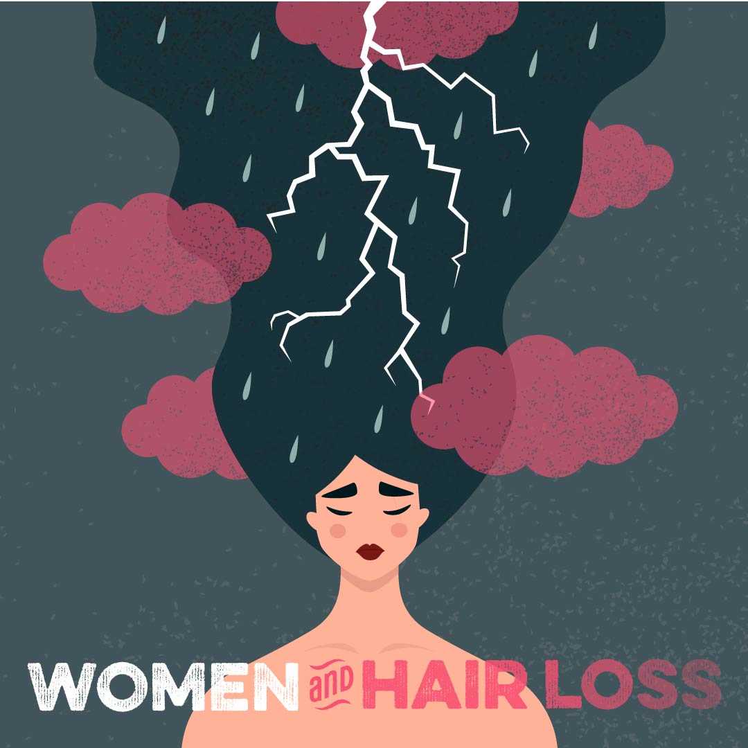What Causes Hair Loss in Women?